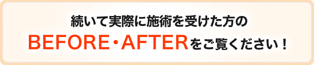 続いて実際に施術を受けた方のBEFORE・AFTERをご覧ください!